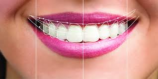 Smile designing procedure Chennai