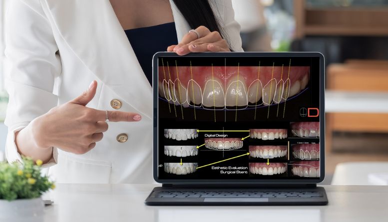 Benefits of smile designing Chennai