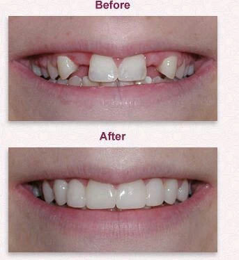 Benefits of oral surgery treatment in Chennai