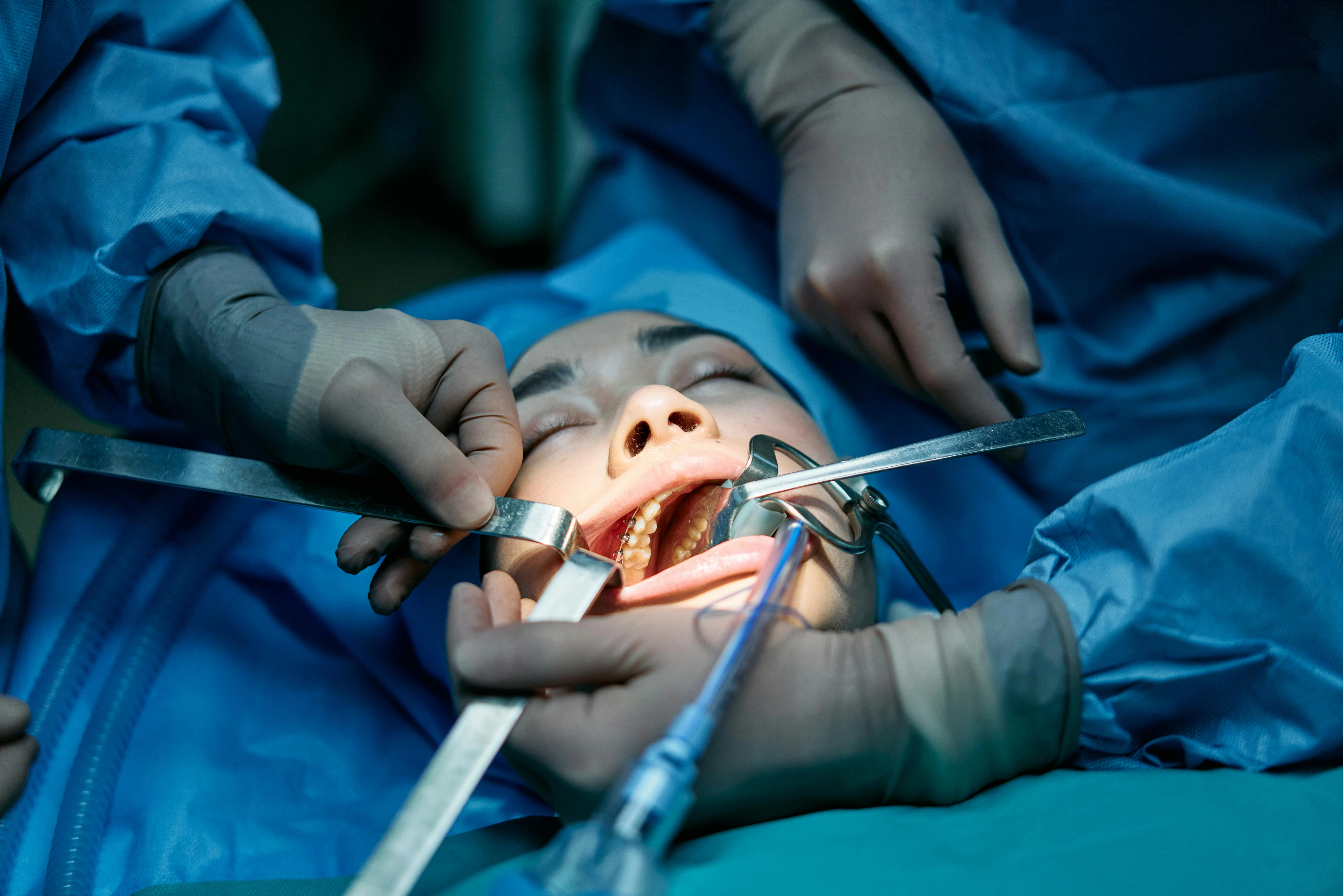 Oral surgery procedure in Chennai