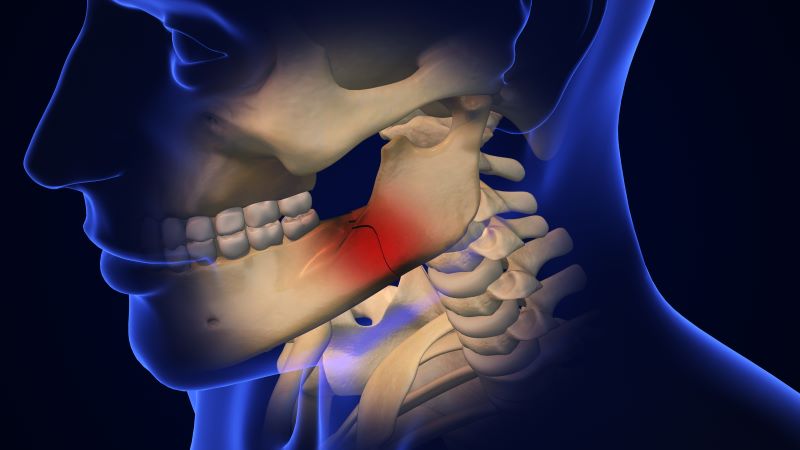 Trauma jaw surgery treatment in Chennai for facial injuries and jaw fractures